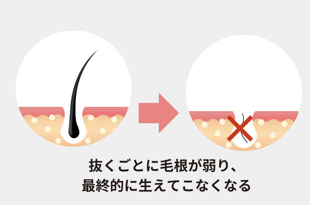 白髪を抜くのは本当にダメ？毛髪診断士に聞いた、白髪を発見した後の対処法 - FRONTROW