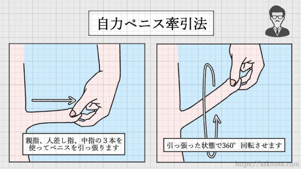 泌尿器科医が解説】ペニス増大トレーニング（チントレ）は効果ナシ！リスクもあり注意！