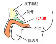 長茎治療 | かじクリニック熊本（メンズサイト）