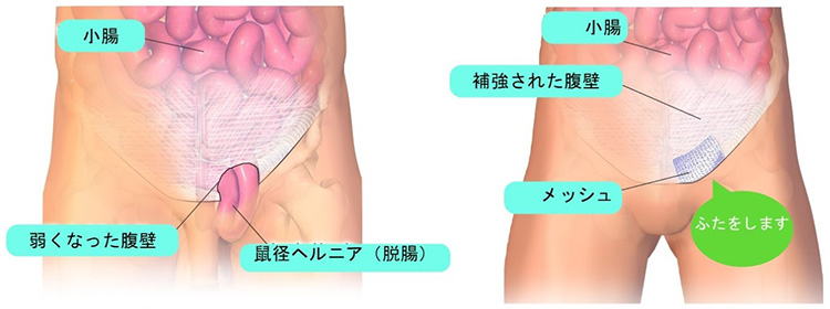 腸活」よりも美と健康に役立つ「2つの習慣」とは？ 整体プロが教えたい排泄力アップのコツ | すぐできる自力整体 |