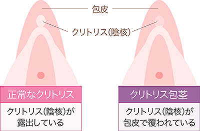 気持ち良くない…感度落ちた？ クリトリスの感度を上げるためにできること |