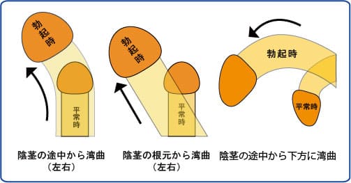 反りチンとは？反り方の違いやおすすめの体位も解説！｜風じゃマガジン