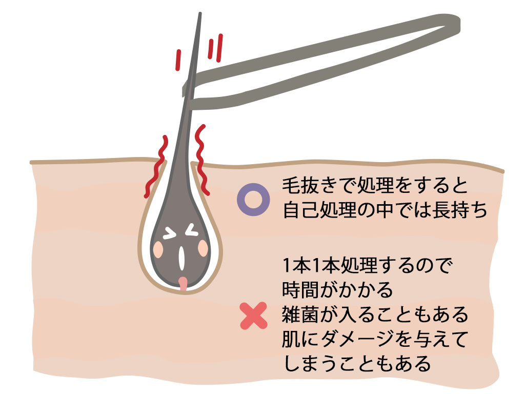 医師監修】「あごひげを抜くと生えてこない」は本当？デメリットや処理方法も解説 | Midashinami 身だしなみ