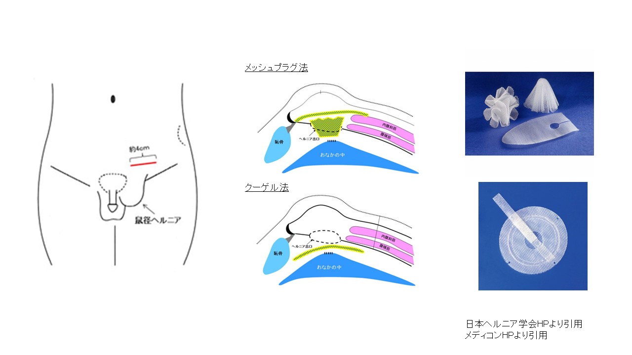 これやってる？股関節の内もも（鼠径部）のストレッチの図解｜とぴー＠からだを楽にするプロ