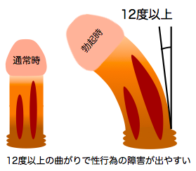 下反りちんぽオナニー射精2