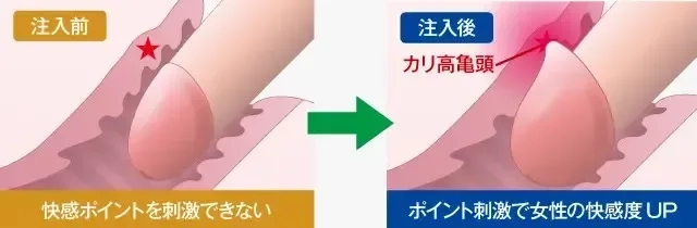 粗チン (そちん)とは【ピクシブ百科事典】