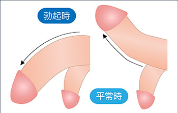 ペニスサイズの測定