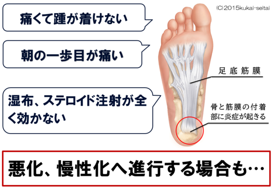 足底の痛み 前橋市の整骨院なら実績多数の前橋アイメディカル鍼灸整骨院｜腰痛・不妊・むちうち