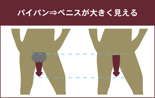 メンズコレクション | ◉カラダから毛がなくなる喜び