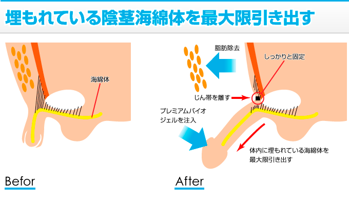 日本人の平均ペニスサイズ（通常時と勃起時）は○○cm！ – メンズ形成外科