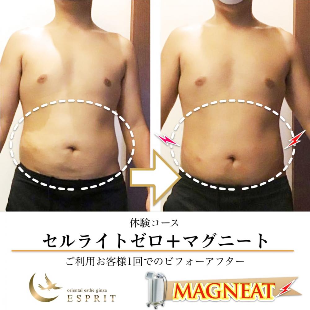 メンズセルフエステ［定額制］男性ダイエット痩身マシン【メンズNAX】