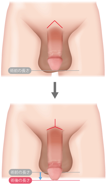 マジメに考える「男性器の誤解」～萎縮は思い込みだった！】日本人の男性器、世界平均より「長くて、若干細い」５０万人の回答で判明  検証では「年齢による大きさの差ない」医学誌が発表（1/3ページ）