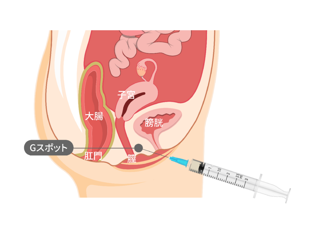 45歳で第3子出産の産後にセックスでイクためのGスポットの見つけ方【産婦人科医監修】 -  臨床心理士・パーソナルトレーナーの小中学生復学支援・小学生・中学生家庭教育支援・