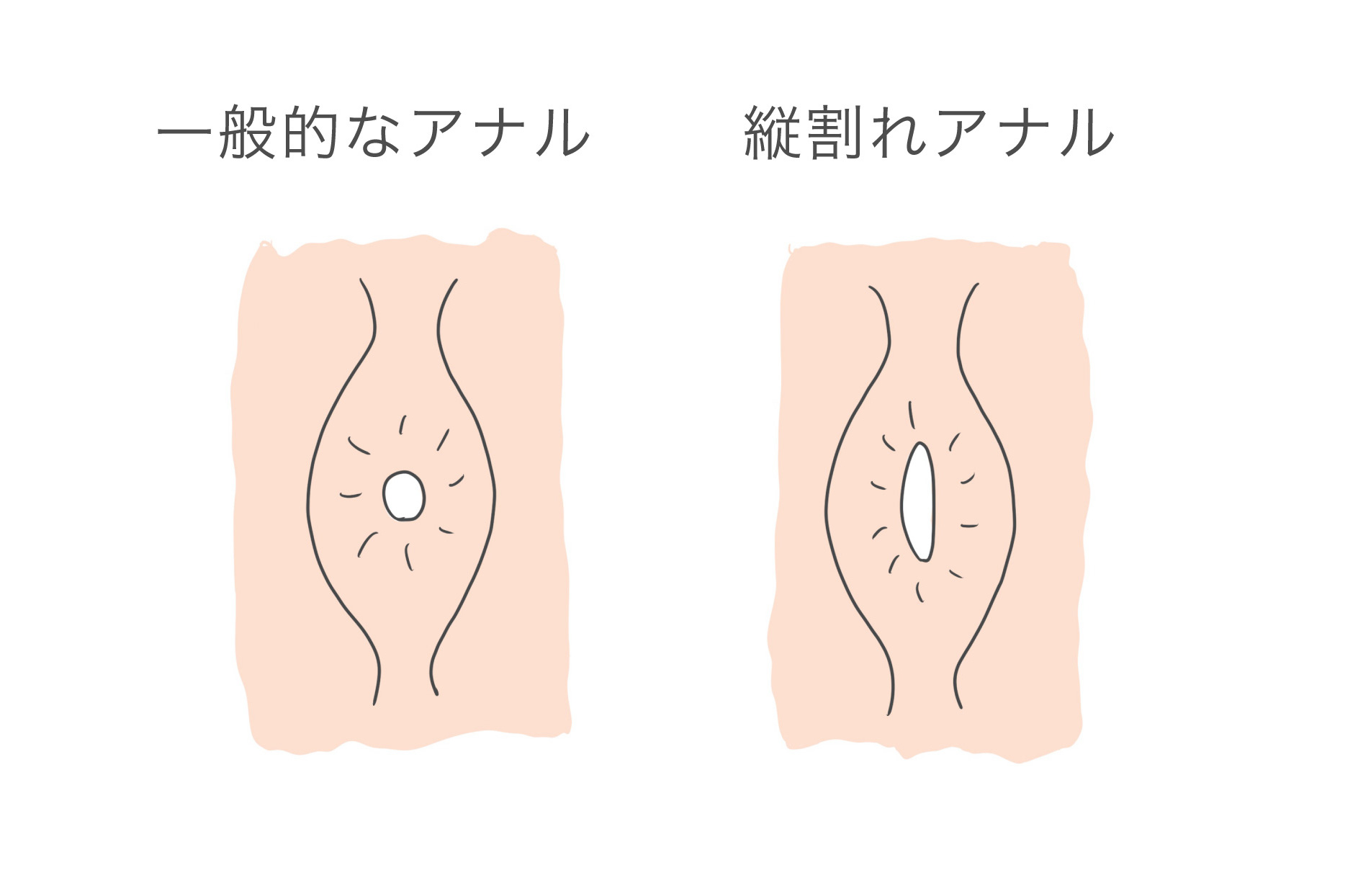 メスイキ小説】彼氏の肛門が縦割れな件 (前編)｜【R-18】前立腺メスイキ中毒者(前立腺・乳首開発済) ～メスイキに人生を捧げた人間～