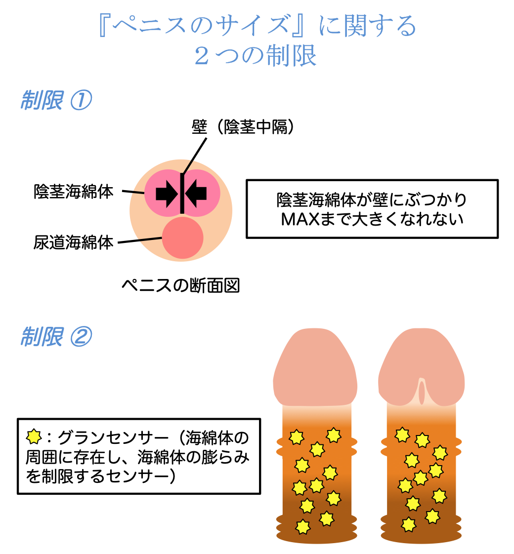 長茎手術（切らない・切る）-東郷美容形成外科 福岡メンズ-福岡・博多で包茎手術・亀頭増大・陰茎増大・長茎治療なら