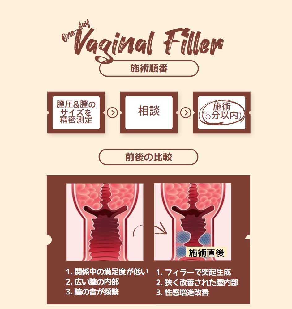 マン屁 (まんぺ)とは【ピクシブ百科事典】