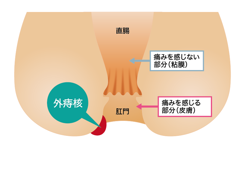 ちゃんといいウンチ出てる？ 知って得するウンチの話 | 済生会