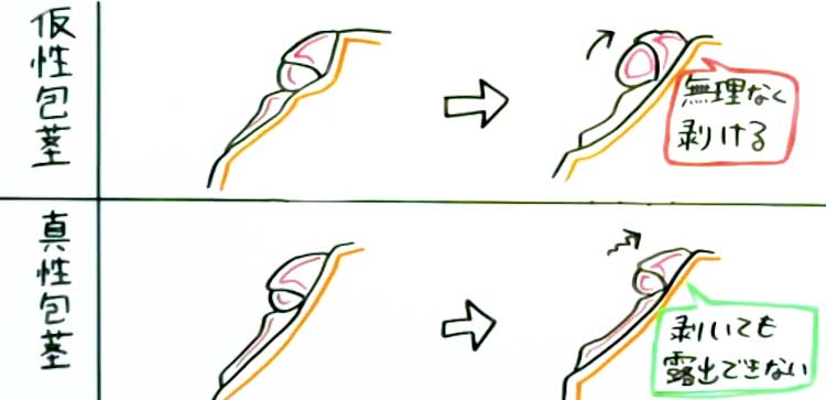 クリトリス初期開発と全体開発 | 悪魔の性典