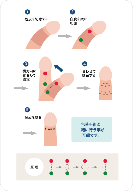 デカ反り マックス |