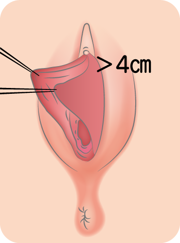 旦那のペニスが小さい？バレず着実にペニスを増大させる3つの方法を解説！ | ザヘルプM