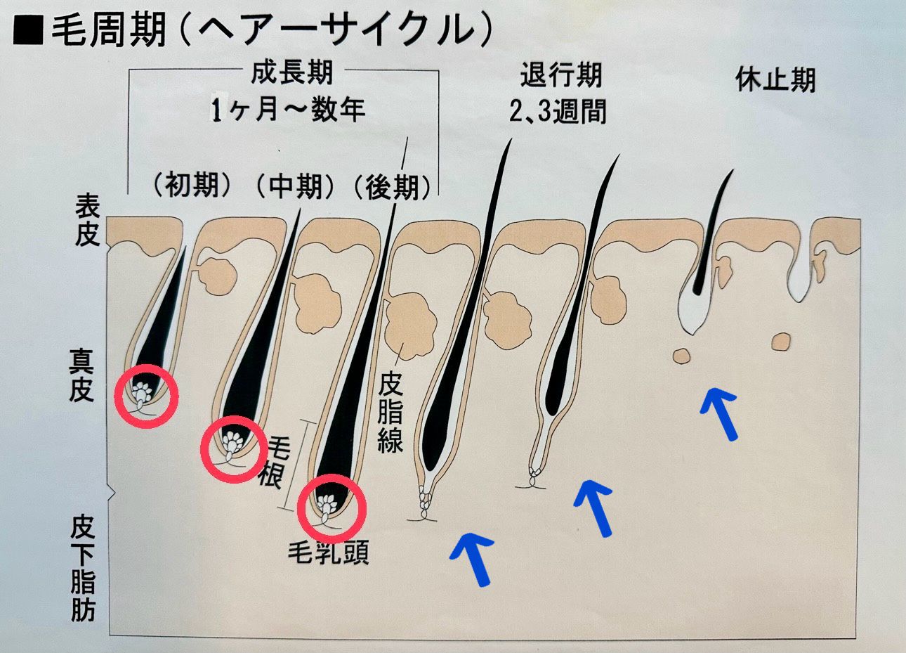 毛抜きはデメリットだらけ？毛抜きで注意しておきたいポイント - 【公式】メンズトータルエステサロン ZELMO(ゼルモ)