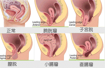 オナホとリアル膣｜オナホと本物～どっちが良い？信長トイズまとめブログ