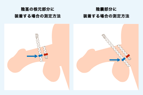 長茎手術なら美容形成専門のMSクリニック【新宿】