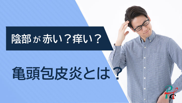 カンジダ性亀頭包皮炎および尖圭コンジローマを合併した一例｜東京・性病