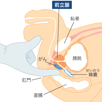 前立腺マッサージとはどんなプレイ？ 風俗エステ嬢がやり方を詳細解説 | シンデレラグループ公式サイト