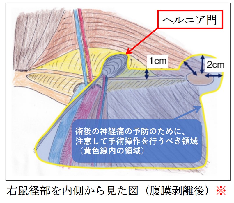 佐野ようこ：大人の鼠径部事情(難波風俗エステ)｜駅ちか！