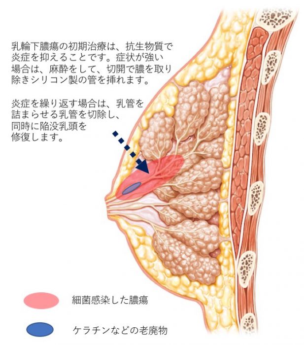 下乳全開,乳輪みえ【Blu-ray】▽国内正規品(セル版)△▽ムチムチ超爆乳▽▽ミルキー・グラマー 伊織いお△▽ の落札情報詳細 - 