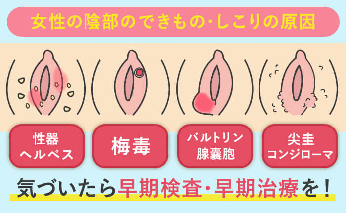 ペニスとクリトリス「勃起・形・メカニズム」の違い【比較完全図解】 | セクテクサイト