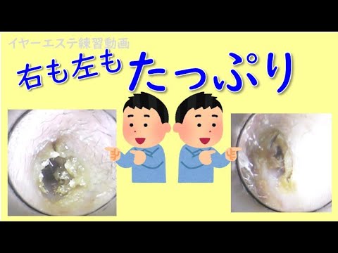 上越市・新潟市/男性も通える耳かき＆リンパマッサージの店『S.free(エスフリー)』