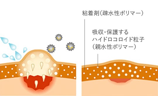 キスマークの消し方とは？ すぐできる対処法を解説｜「マイナビウーマン」