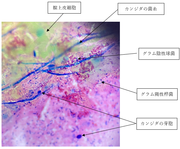 性器や陰部の臭い（匂い）に違和感があるときに考えられる男女別の性病の種類とは？ ｜ 家来るドクター