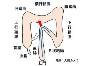 えじす郷三番地｜【レビュー】アナルマニアオタクとアナニー大好きお嬢様～奇跡のマッチング～（Pin-point/Pin-point Quick）