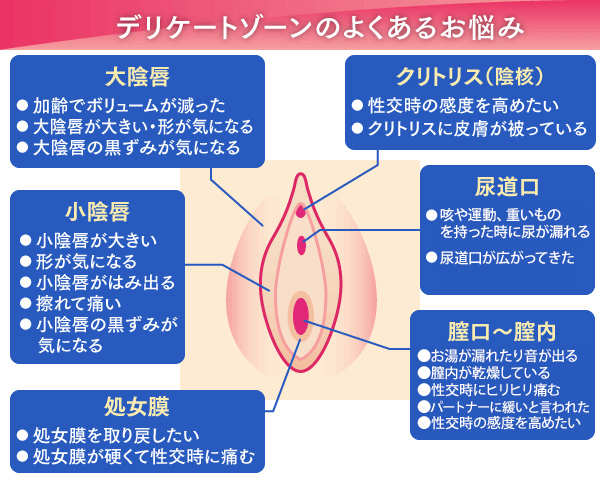 副皮 クリトリス包茎 |