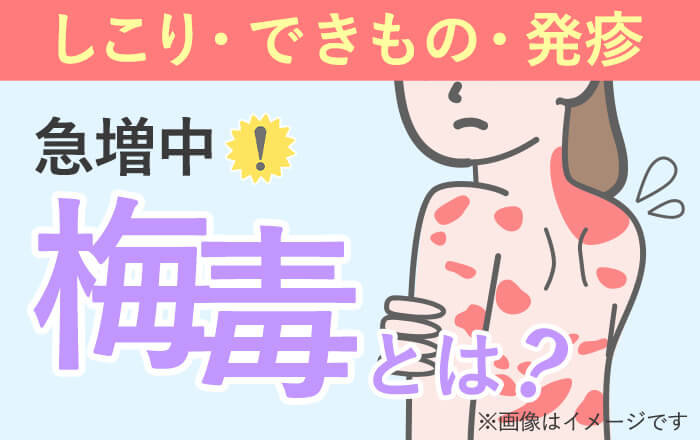 署名活動とは？署名活動のやり方や法的効果を分かりやすく解説！法的拘束力の有無や事例の紹介も！ | GMOサインブログ | 電子契約ならGMOサイン