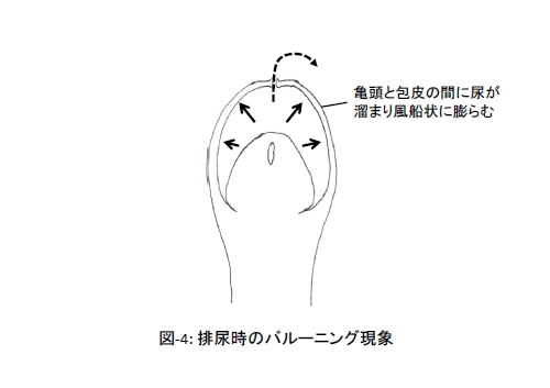 ペニスの皮に関わる病気や治療法について ｜包茎手術・治療なら上野クリニック