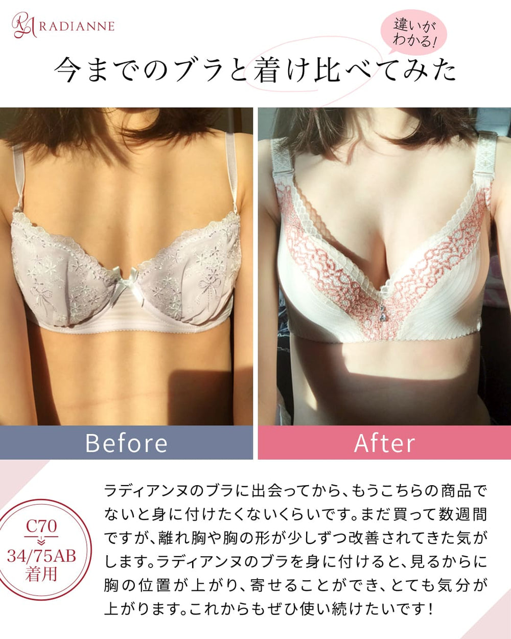 貧乳でも豊胸を成功させるコツ｜豊胸術の注意点も解説 | 銀座マイアミ美容外科