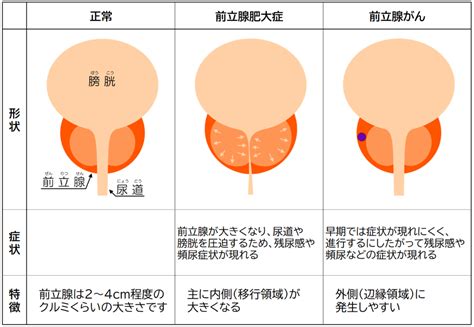 ☆男の潮吹き☆やり方、コツを【男の潮吹き】発祥の風俗店が解説 | 男のメスイキ！ドライオーガズムとは？