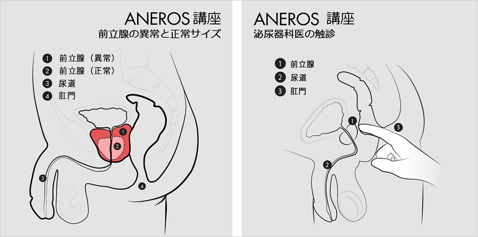 SM好きが解説】SMプレイの1つ尿道責め！正しい手順と注意点を伝授！ | Trip-Partner[トリップパートナー]