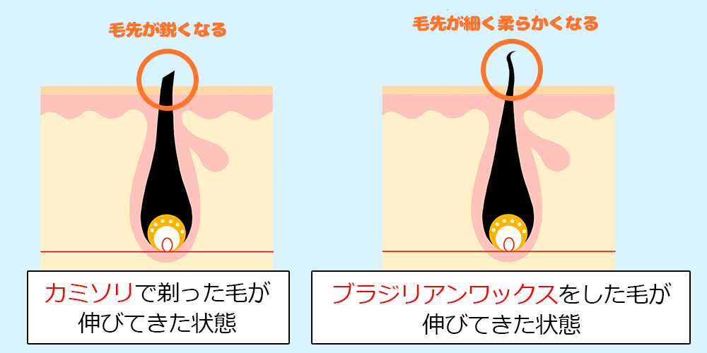 ヒゲを抜き続けると肌がボロボロに！確実にヒゲの悩みを解決する方法 | メンズ脱毛百科事典