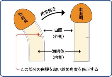 18歳・19歳でちんこはどうあるべき？18歳・19歳で皮がむけてないのは？ | 【フェアクリニック】包茎・薄毛・男の悩み相談所