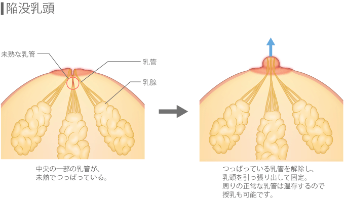 Amazon | おつまみ