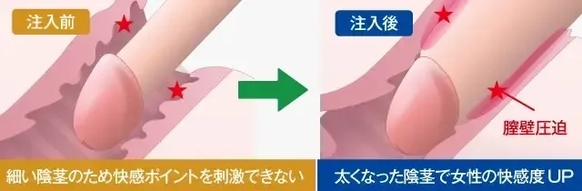 メスに男性器？そこから出産！？ ブチハイエナのリスクしかない進化