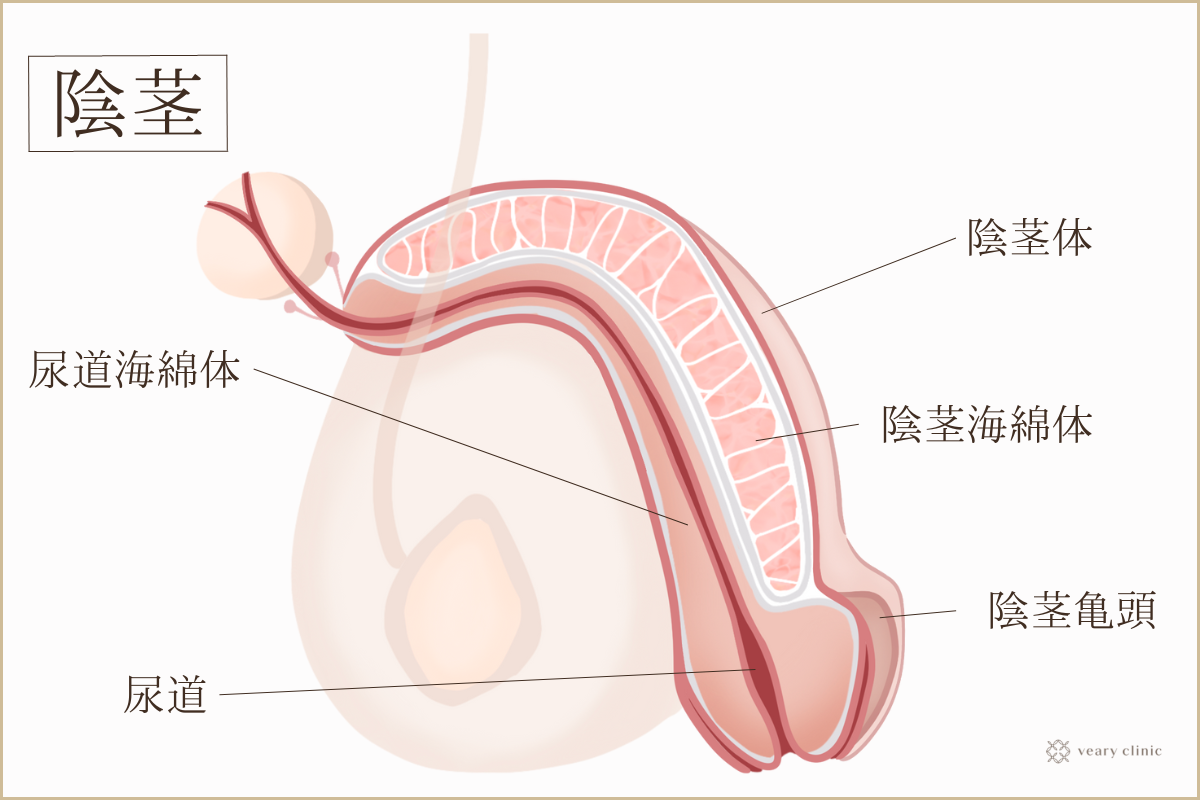 症例112 60代 陰茎増大術後のカリを高くする手術