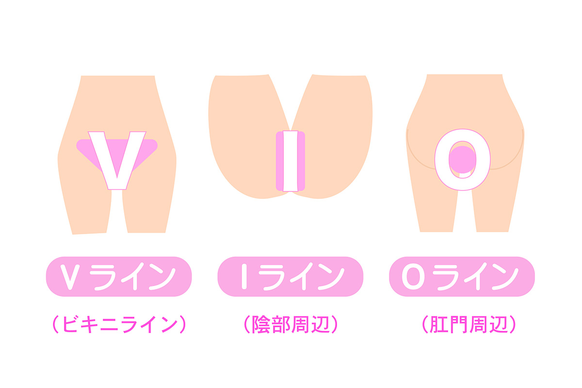 VIO脱毛前の自己処理はどこまでする？全剃り？綺麗に剃る正しい方法や注意点まとめ | ミツケル