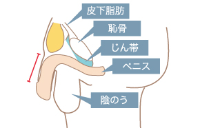 泌尿器科の専門医が解説】ペニスを大きくする方法〜自力・サプリ・器具・手術〜