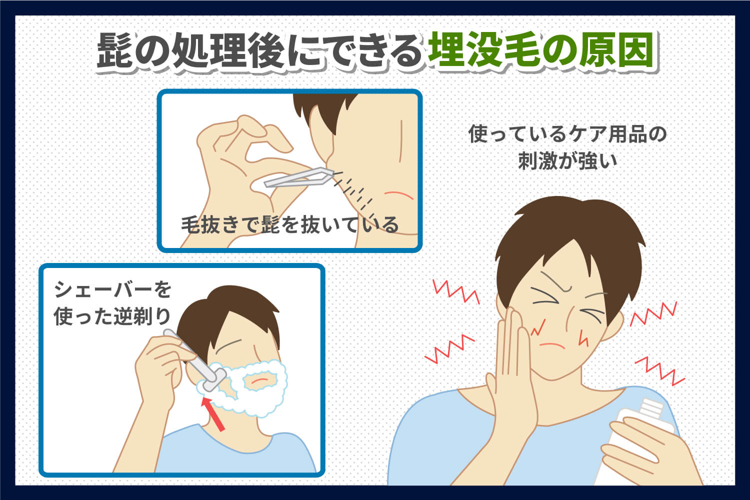 伸び散らかしたアゴヒゲを毛抜きで一気に全部抜いてみた（後編） 2019.10.23 【Plucking facial hair】